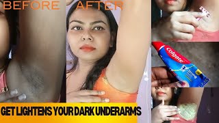 Home Remedy Tips UnderArms WhiteningRid Dark Spots patches  Skincare tips [upl. by Gwenore28]