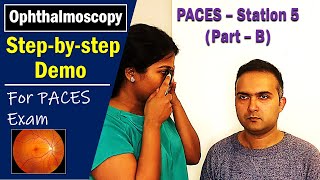 PACES UK Station 5 OphthalmoscopyFundus Exam Stepbystep Howto Guide [upl. by Yniatirb803]