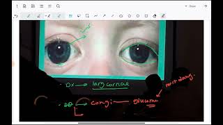 ophthalmology spotting 2023 part 1 [upl. by Melia]