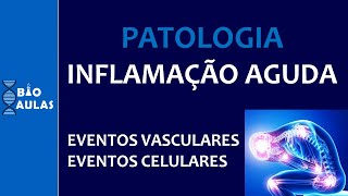 Inflamação Aguda  Eventos Vasculares e Eventos Celulares Patologia Geral [upl. by Kcyred]