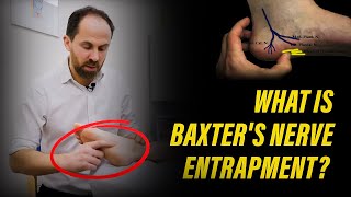 What is Baxters Nerve Entrapment [upl. by Odlavso]