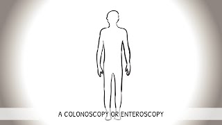 Koloskopie Innere Medizin [upl. by Adai]