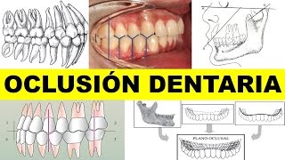 quotOCLUSIÓN DENTARIAquot por el Dr Hugo Perez [upl. by Ellesij223]