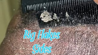 💜 Big Flakes Sides w CojonaJ [upl. by Sand]