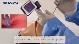 How to get the best view for airway intubation with video laryngoscope [upl. by Patti]