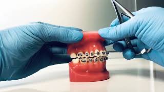 Uitleg Driehoek Elastieken • Kelderman Orthodontie [upl. by Ardy]