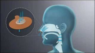 Provent Therapy Mechanism of Action How EPAP Works [upl. by Atileda916]