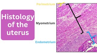 Histology of the uterus  Perimetrium Myometrium and Endometrium [upl. by Delora958]