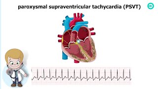 Types and ECG features of Supraventricular Tachycardia SVT [upl. by Yrdua]