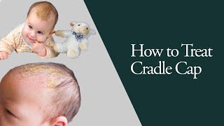 How to Unlock the Secrets of Baby Cradle Cap  Tips and Tricks for Happy Healthy Skin [upl. by Tharp984]