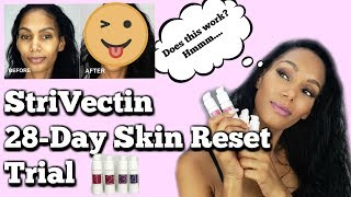 I Did the STRIVECTIN 28DAY SKIN RESET TRIAL  Skincare Review [upl. by Bodwell]