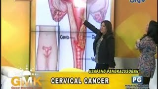 Understanding Cervical Cancer [upl. by Maris923]