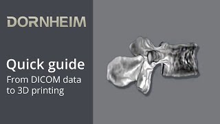 quick guide  From DICOM data to 3D printing [upl. by Michel]