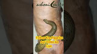 Leech therapy for vericose veinBest treatment for vericose vein  Leech therapy videos [upl. by Ecilayram964]