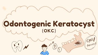 Odontogenic KeratocystOKCOdontogenic cyst [upl. by Aderb174]