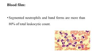 Chronic neutrophilic leukemia [upl. by Aret892]