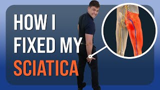 How I Healed My Sciatica Personal Recovery Story [upl. by Consuela]