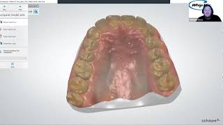 Webinar 3Shape Aligner Studio with Ortho Analyzer with Matthew Davis [upl. by Einaej]