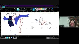 CURSO ANATOMIAXESQUEMAS  4ta Clase  Grandes Vasos 2° parte Arteria Pulmonar Venas y Linfáticos [upl. by Akcimahs]