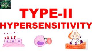 Type II Hypersensitivity  Antibody mediated Hypersensitivity  Mechanism  Examples [upl. by Ahsinom]