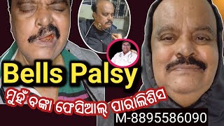 Bells PalsyFacial paralysis बेल्स पाल्सी ମୁହଁ ବଙ୍କା ହୋଇ ପାରାଲିଶିସ ଫିଜିଓ ଥେରାପିphysiotherapy [upl. by Aynek981]