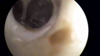 Cat Myringotomy using MedRx Digital Video Vetdock System [upl. by Retsam]