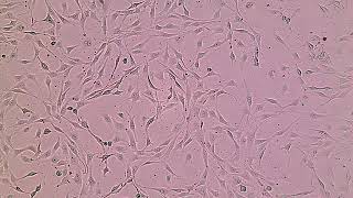 Timelapse cell imaging NIH3T3 cells by CytoWatcher ATTO [upl. by Zuckerman]