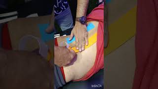 Kinesio Taping For Low Back Painkinesiotapinglowbackpain taping chiropractic shortsfeed [upl. by Sylera432]