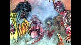 Impetigo  Boneyard  Horror Of The Zombies [upl. by Hall]