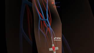 How This Cannula Procedure Transformed My Body 3D Animation shorts 3danimation cannula anatomy [upl. by Ahseem]