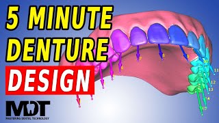 The Fastest Copy Denture Result  Exocad 32 Elefsina Design Tutorial [upl. by Hgielyak]