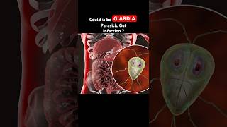 Giardia Infection is often mistaken for IBS Symptoms guthealth shorts youtubeshorts [upl. by Annot]