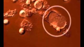 Time lapse video of the Chlamydia trachomatis developmental cycle [upl. by Feltie]