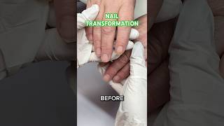 Nail transformation 💚✨ nails nailtrends nailtransformation greennails [upl. by Kinna]