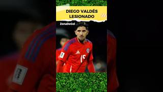 Diego Valdés Se Lesiona [upl. by Ynaiffit]