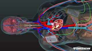 AED in Action  A 3D look inside the body [upl. by Coffey]