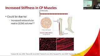 the impact of collagenase on passive and active properties of muscles in children with CP by F Syed [upl. by Silvers598]