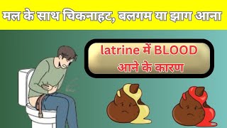 मल के साथ चिकनाहट बलगम या झाग आने के कारण latrine me aav aana blood wali potty aane ke reasons [upl. by Narak]