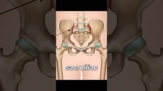 Sacroiliitis  lower back pain [upl. by Refinney]