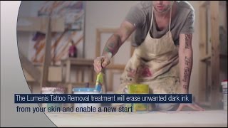 Tattoo Removal Treatment  Lumenis [upl. by Aicylla]