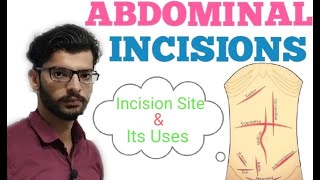 Abdominal Incisions  BY Sohan Chhillar [upl. by Stavro]