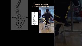 Simple Scoliosis Correction Exercise Lower Back [upl. by Faunia]