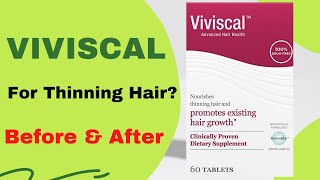 How Good Is Viviscal Hair Growth Supplements Honest Review [upl. by Rolecnahc]