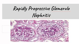 Rapidly Progressive Glomerulonephritis  RPGN [upl. by Jorey]