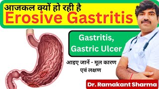 Gastritis  Gastric Ulcer  Erosive Gastritis Treatment in Naturopathy in Hindi dr ramakant sharma [upl. by Anohs]