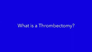 ESD Patient Pathway Thrombectomy Animation [upl. by Hacceber]