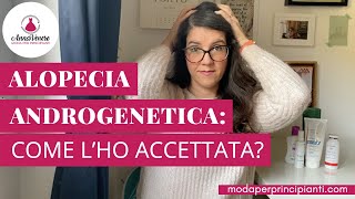 Alopecia Androgenetica come lho accettata [upl. by Letsirc]