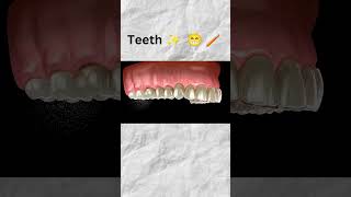 dentist music teeth whiting teethviralvideo shorts [upl. by Ahsakal235]