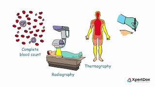 Spanish  ¿Qué es la eritromelalgia What is erythromelalgia [upl. by Kcirdneked820]