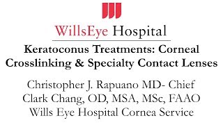 Keratoconus Treatments Corneal Crosslinking amp Specialty Contact Lenses [upl. by Introk445]